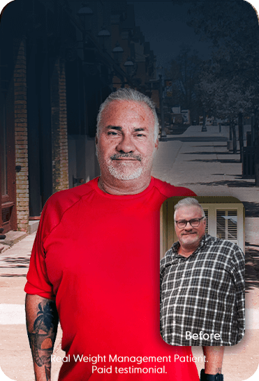 Weight management patient before and after